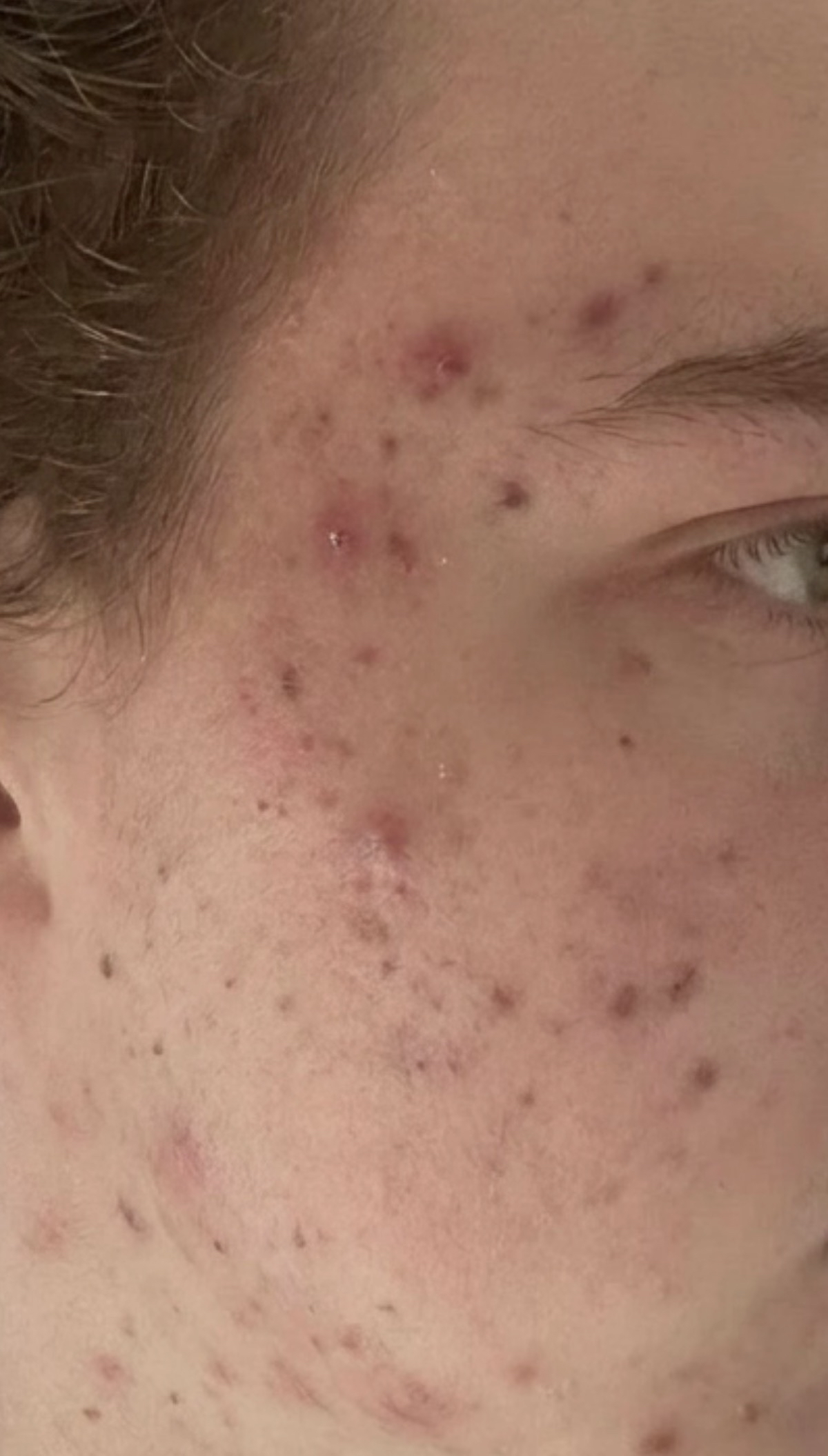 Skin before